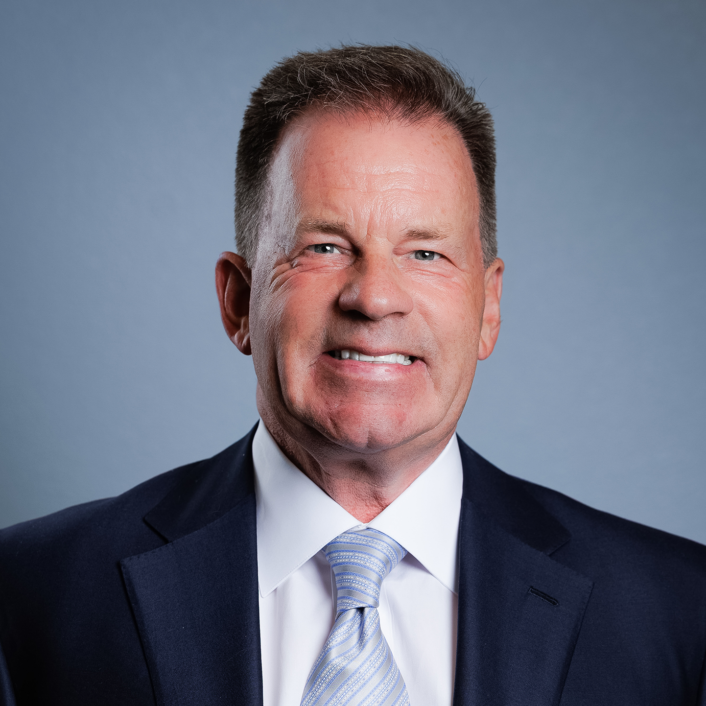 Dr. James Lynch is a Reno neurosurgeon who specializes in minimally invasive spine surgery including endoscopic spine surgery, endoscopic discectomy. Endoscopic spine procedures can be an alternative to laser spine surgery. Dr. Lynch is the founder of Spine Nevada and has three fellowships in the specialty of spine.