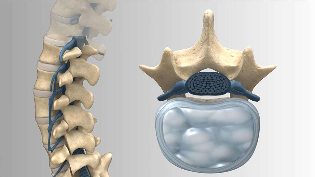 Minimally Invasive Spine Surgery