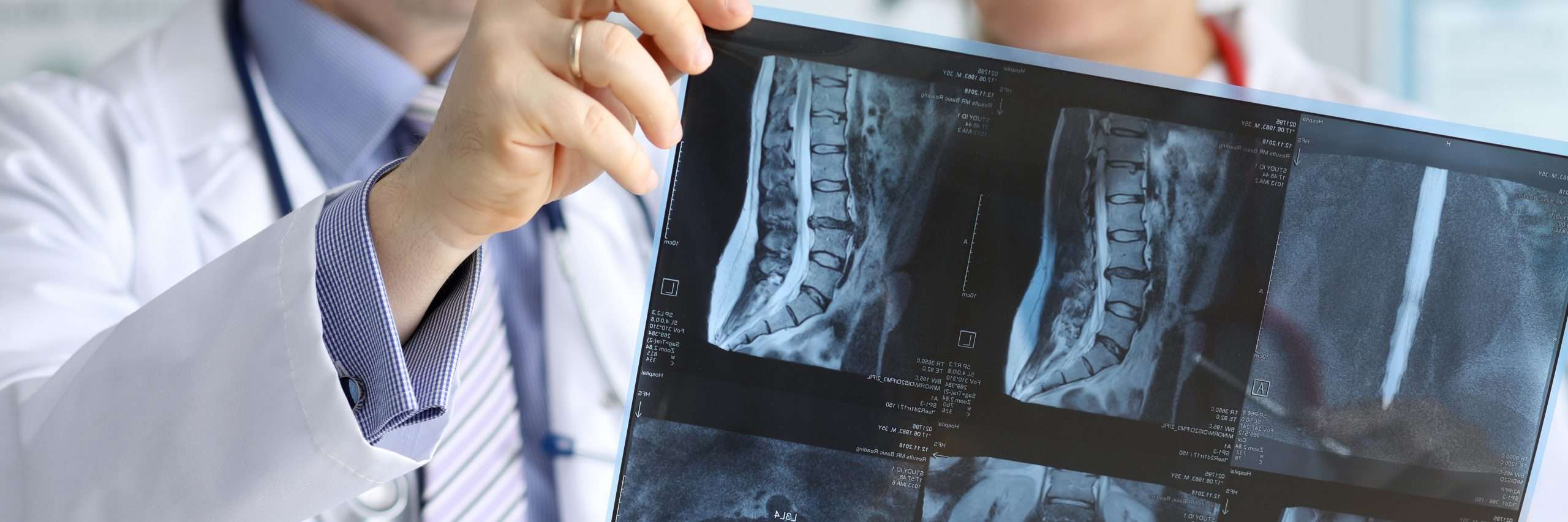 Doctor with co-worker speaking about radiogram