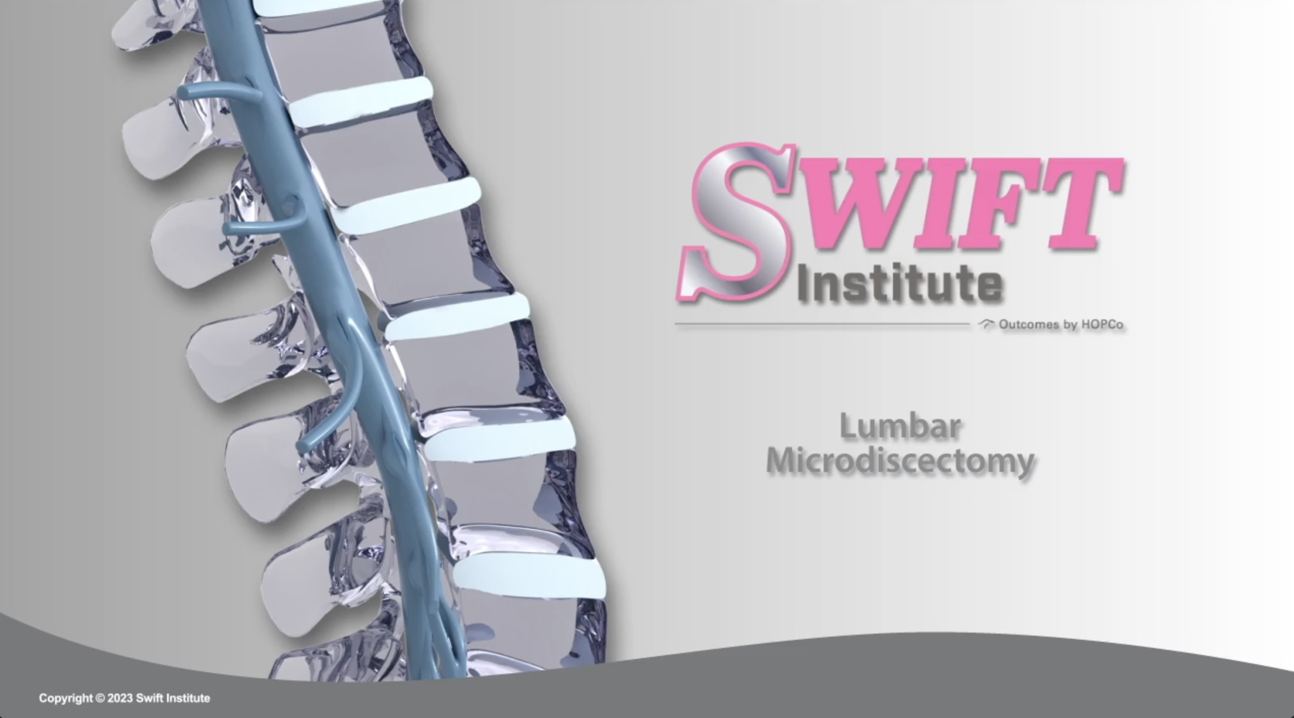 Lumbar Microdiscectomy
